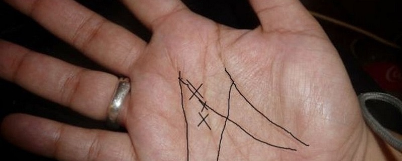 Only 3% People Have Letter X On Their Palms: Do You Have It?